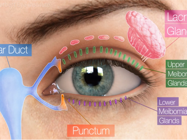 Eye Conditions